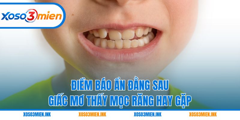 Điềm báo ẩn đằng sau giấc mơ thấy mọc răng hay gặp