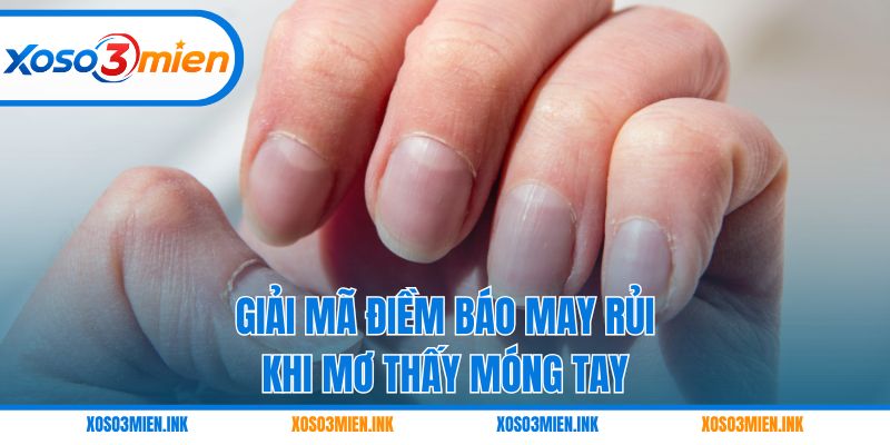 Giải mã điềm báo may rủi khi mơ thấy móng tay